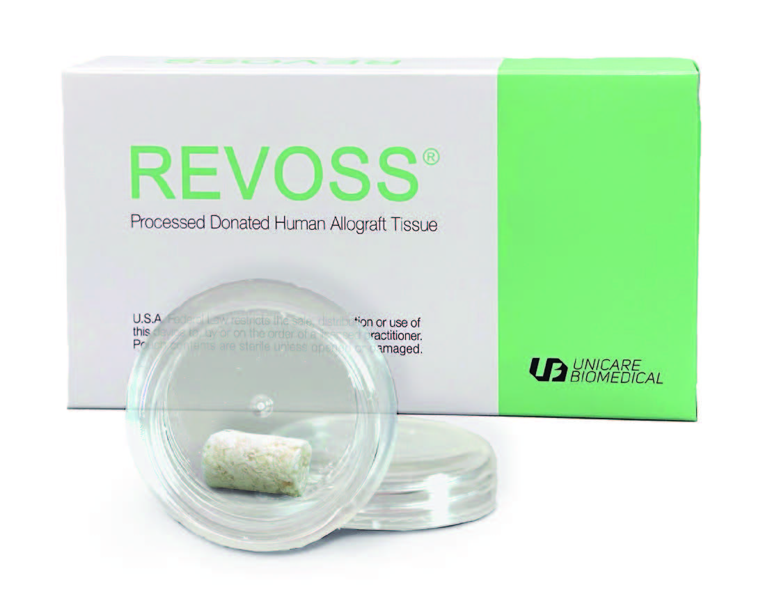 Revoss® Matrix Insert